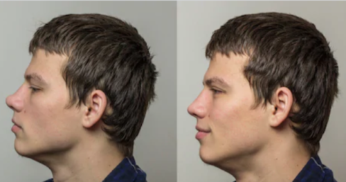 Before and after — CASE 02 · DANIEL