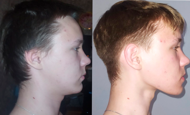 Before and after — CASE 03 · ALEX